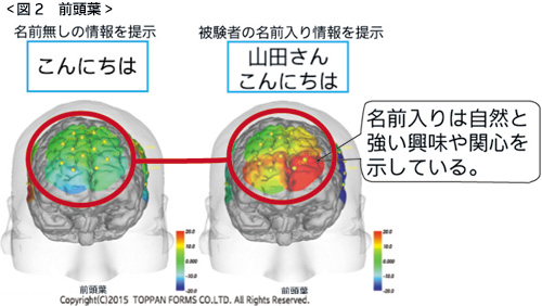 測定時の脳の反応　図2　前頭葉